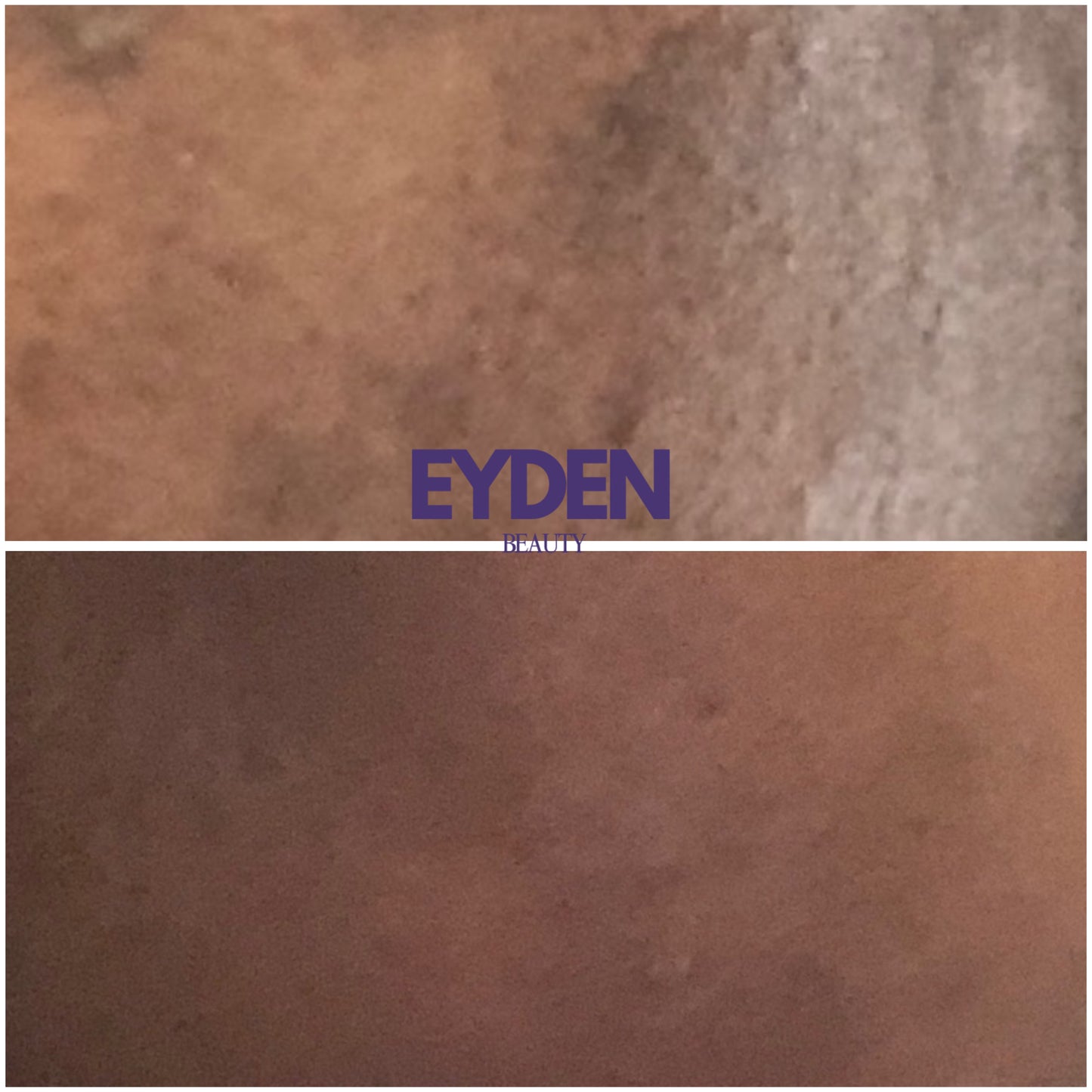 DOUBLE ÉCLAT Huile Éclaircissante - Eyden beauty