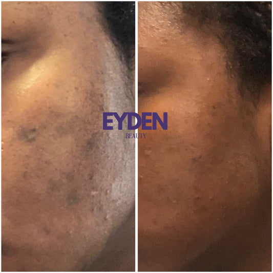 Eyden Beauty ÉCLAT 3 en 1 – Huile Corps & Visage Illuminatrice & Unifiante