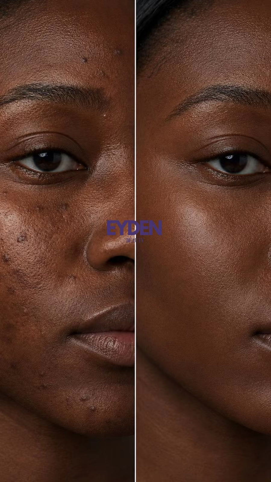 Avant / Après · Sérum — femme à la peau foncée